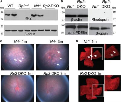 Structural but Not Functional Alterations in Cones in the Absence of the Retinal Disease Protein Retinitis Pigmentosa 2 (RP2) in a Cone-Only Retina